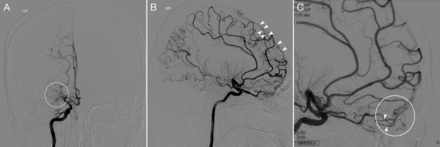 FIG 4.