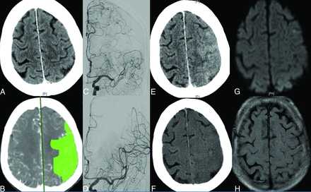 FIG 2.