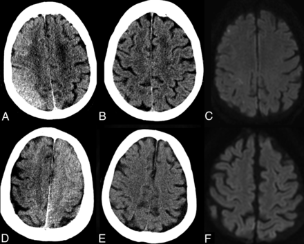 FIG 3.