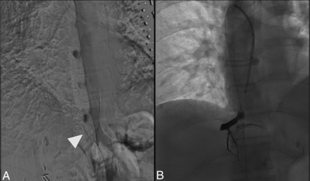 FIG 3.