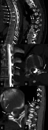 FIG 2.