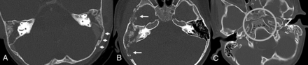 FIG 4.