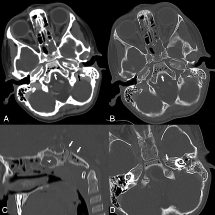 FIG 6.