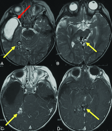 FIG 1.