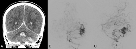 FIG 2.
