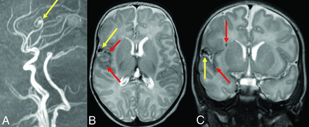 FIG 3.