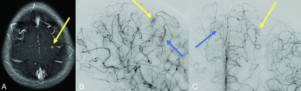 FIG 4.
