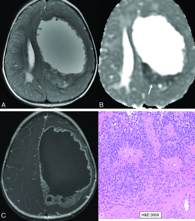 FIG 2.