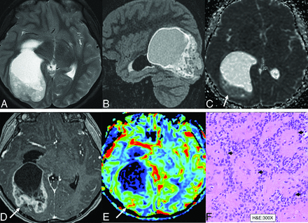 FIG 3.