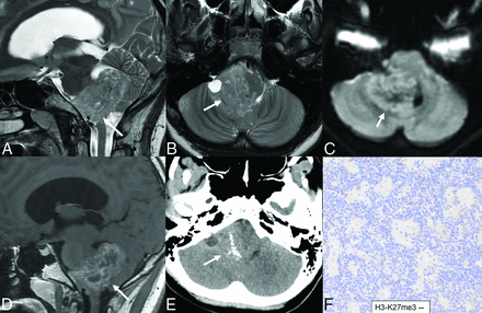 FIG 4.
