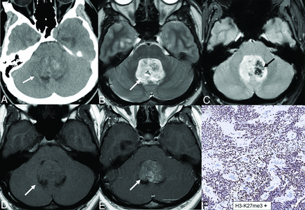 FIG 5.