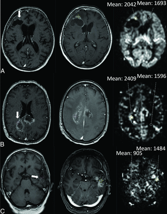 FIG 1.