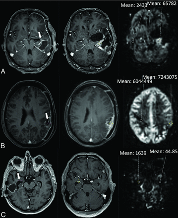 FIG 2.