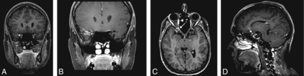 FIG 1.