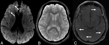 FIG 1.