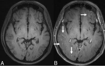 FIG 2.