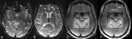 FIG 4.