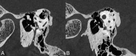 FIG 2.