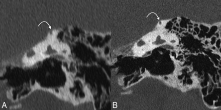 FIG 3.