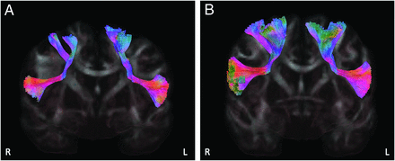 FIG 3.