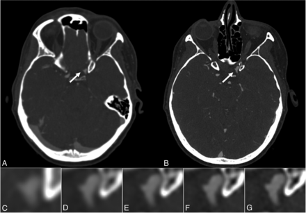 FIG 1.