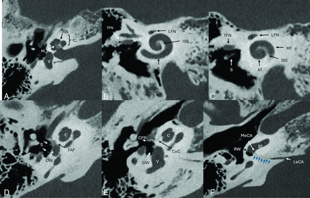 FIG 1.
