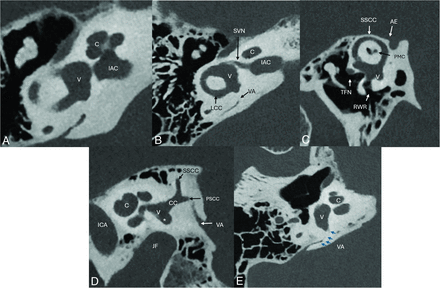 FIG 2.