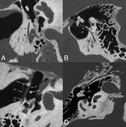 FIG 4.