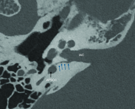 FIG 5.
