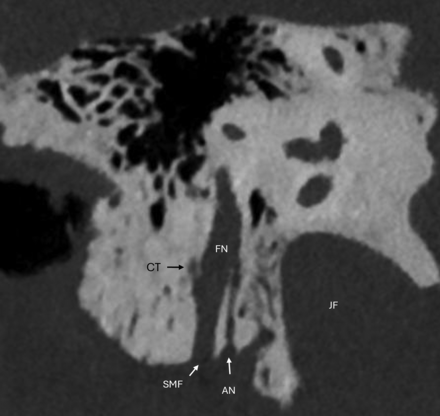 FIG 6.