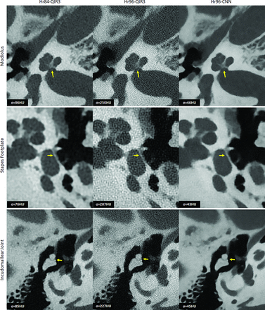 FIG 4.