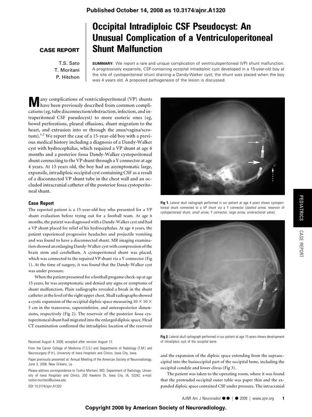 PDF extract preview