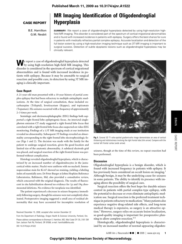 PDF extract preview