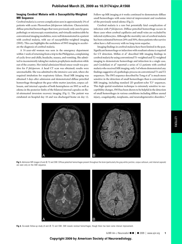 PDF extract preview