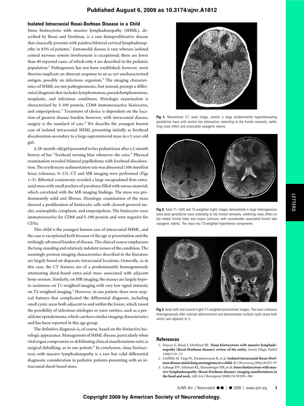 PDF extract preview