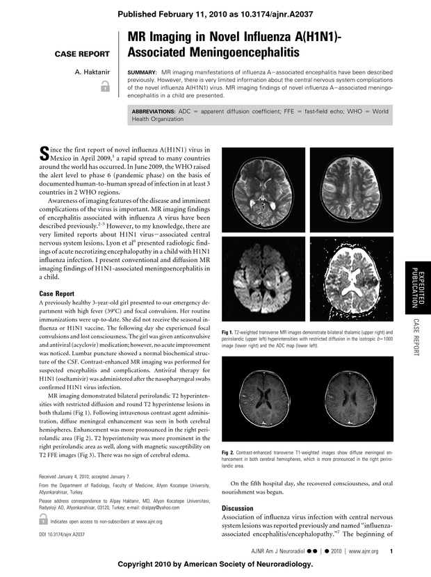 PDF extract preview