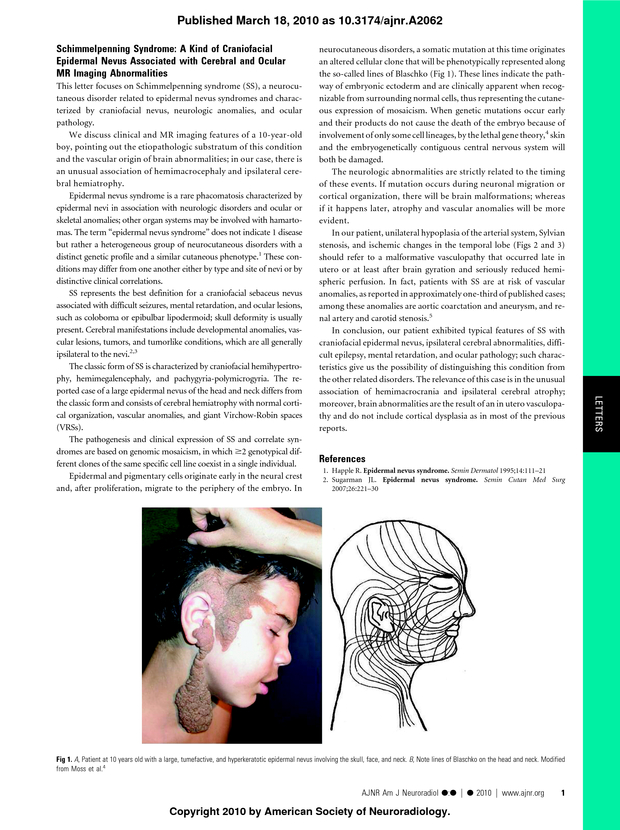 PDF extract preview