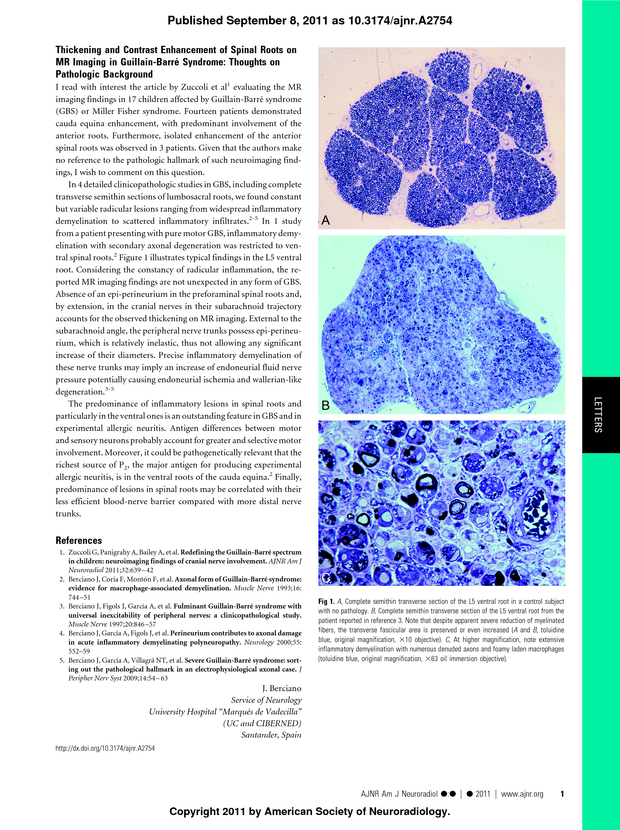 PDF extract preview