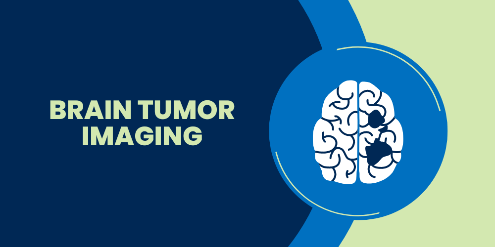 brain_tumor_imaging.png