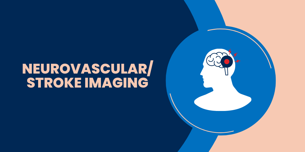 neurovascular_stroke_imaging.png