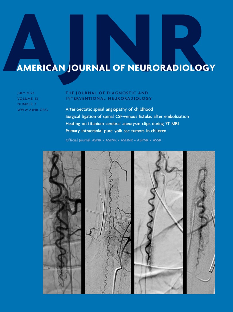 Assessment of Heating on Titanium Alloy Cerebral Aneurysm