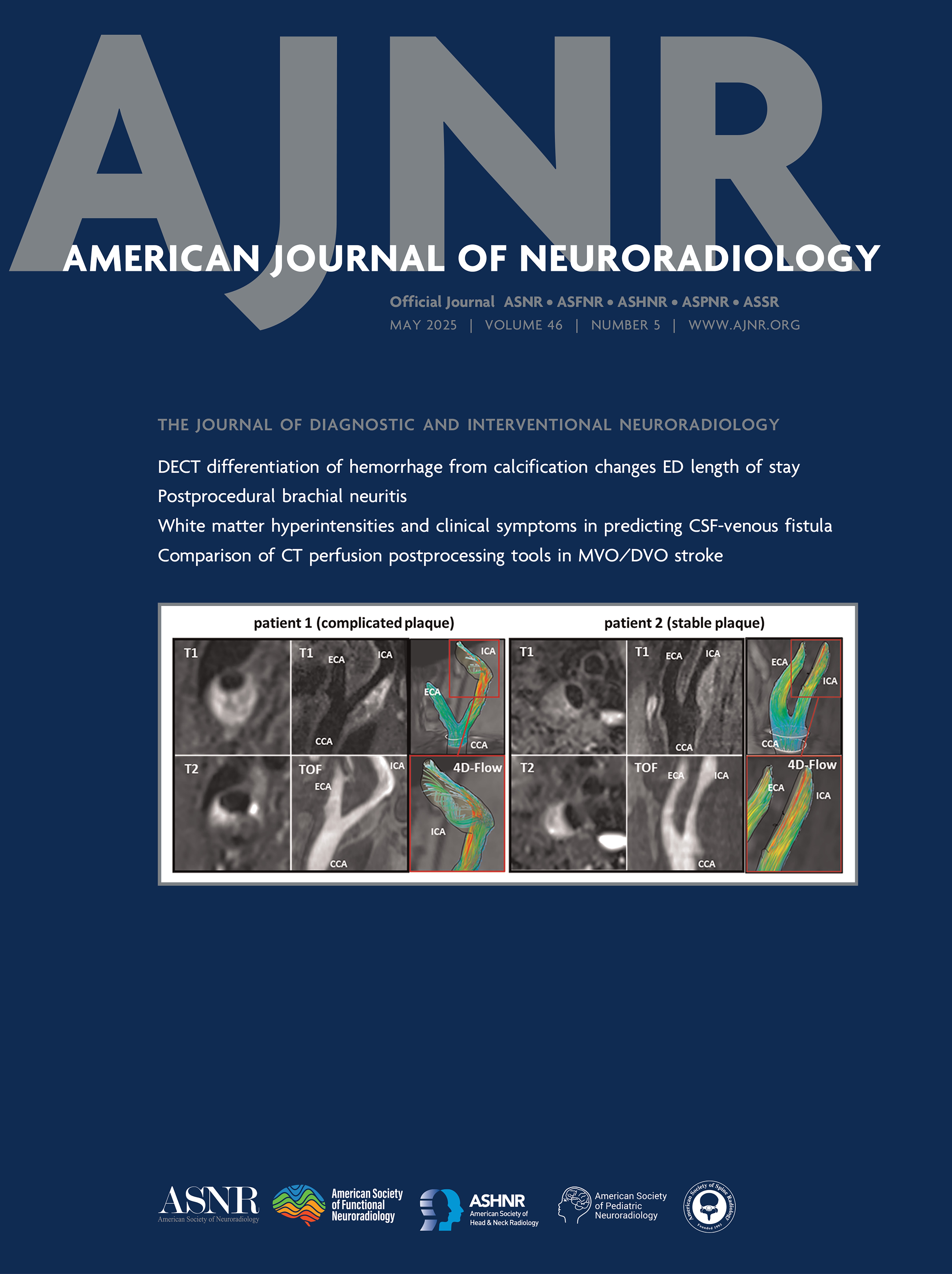 American Journal of Neuroradiology