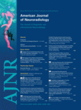 American Journal of Neuroradiology: 31 (7)