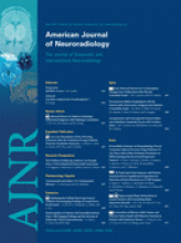American Journal of Neuroradiology: 32 (4)