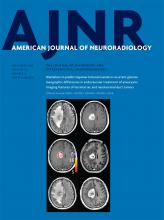 American Journal of Neuroradiology: 37 (11)