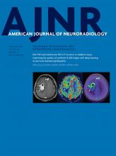 American Journal of Neuroradiology: 40 (2)