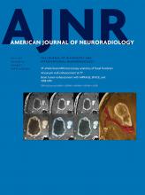 American Journal of Neuroradiology: 40 (7)