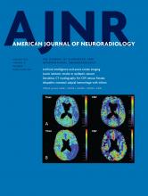 American Journal of Neuroradiology: 42 (1)