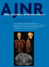American Journal of Neuroradiology: 43 (11)