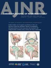 American Journal of Neuroradiology: 45 (10)